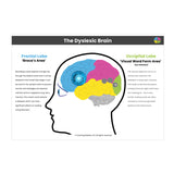 The Dyslexic Brain A3 Poster